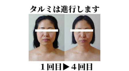 口腔内トラブル専門家 たるみ･小顔サロンNicoのサブ写真１
